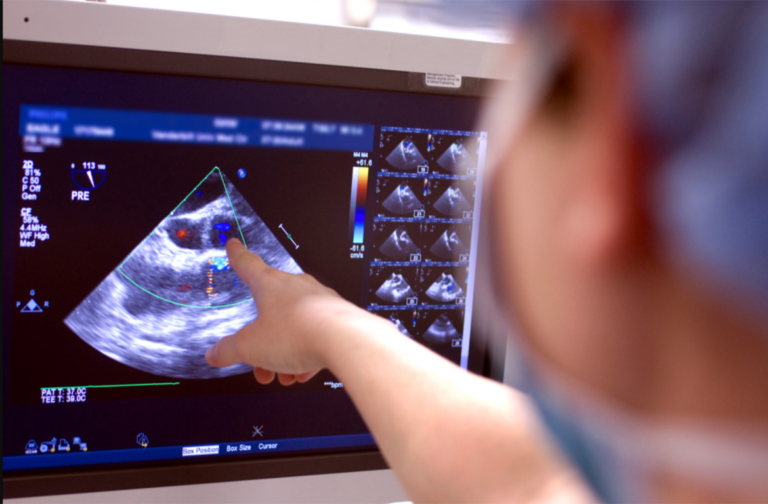 Передовой метод кардиодигностики в Medpark