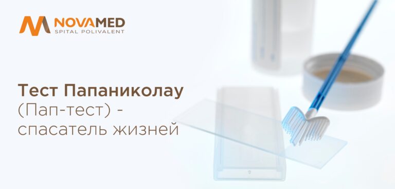 Eugeniu Goroșenco, medic chirurg-ginecolog: Testul Papanicolau (Pap test) – salvator de vieți