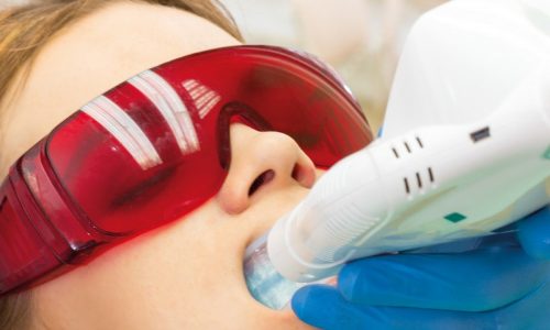 Юлия Окульская в клинике UniDentArt