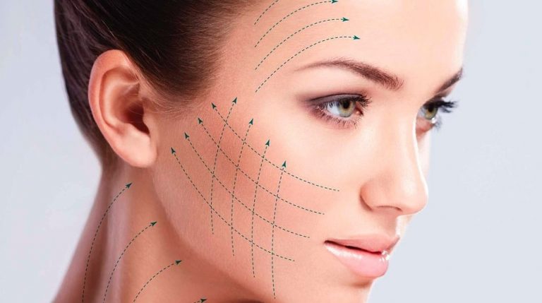 SMAS-лифтинг – инновационная методика подтяжки лица без хирургического вмешательства