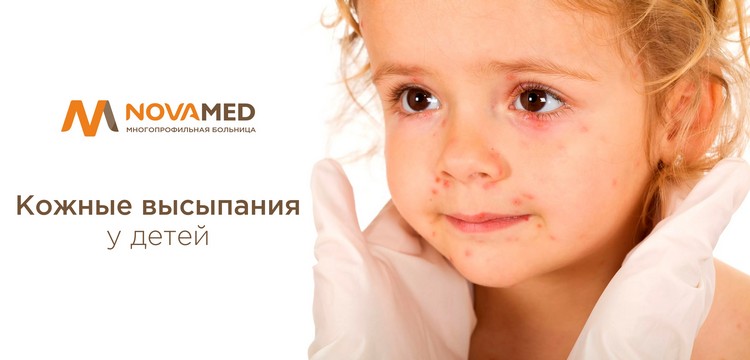 Novamed: кожные выспания у детей