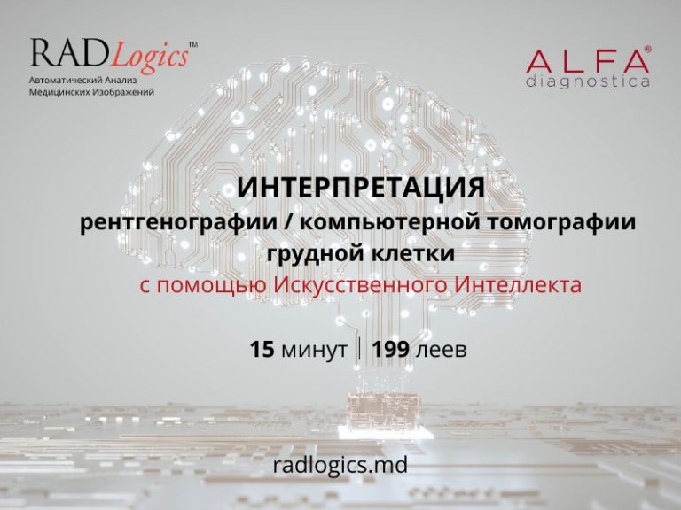 Искусственный интеллект поможет распознать COVID-19 пневмонию