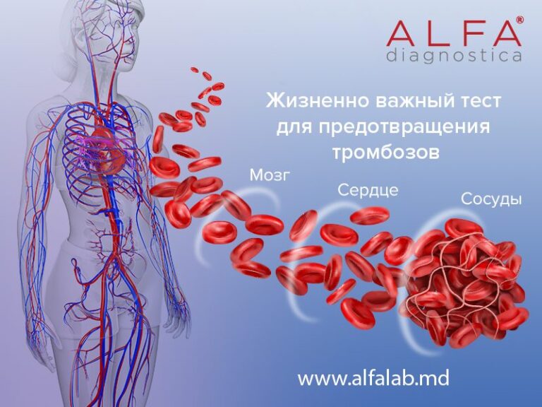 Alfa Diagnostica: жизненно важный анализ для принимающих clopidogrel (Plavix)