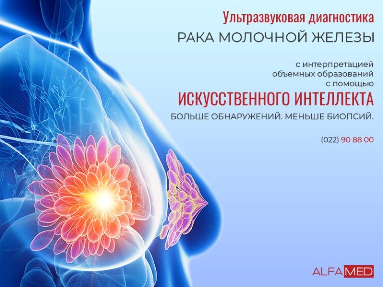 Ранняя диагностика РАКА МОЛОЧНОЙ ЖЕЛЕЗЫ (РМЖ) с помощью Искусственного Интеллекта!