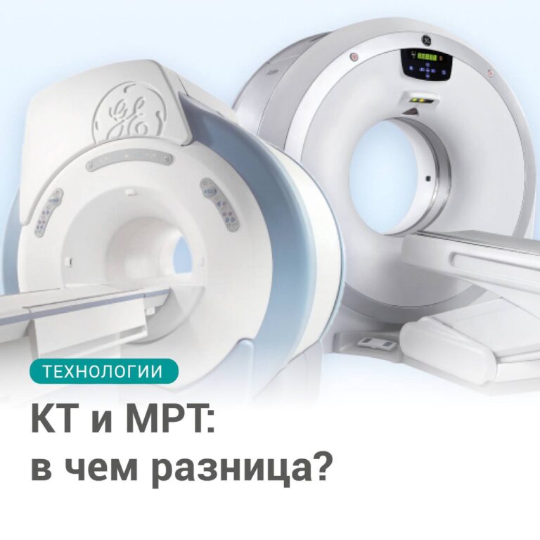 КТ и МРТ: в чем разница?