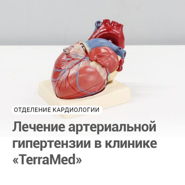Лечение артериальной гипертензии в клинике TerraMed
