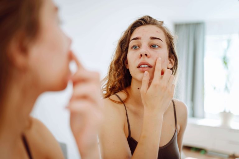 Чистая кожа без акне: успокаивающий и противовоспалительный уход для молодой кожи со средствами, содержащими экстракты трав